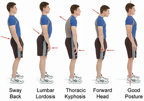 bad-posture